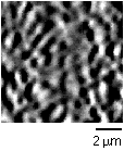 collagen